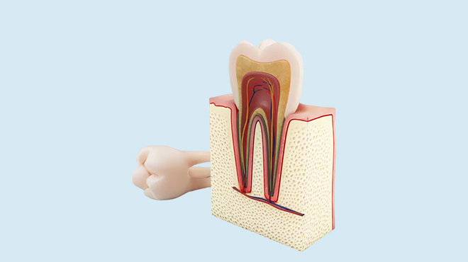Root Canal Therapy in Oakville