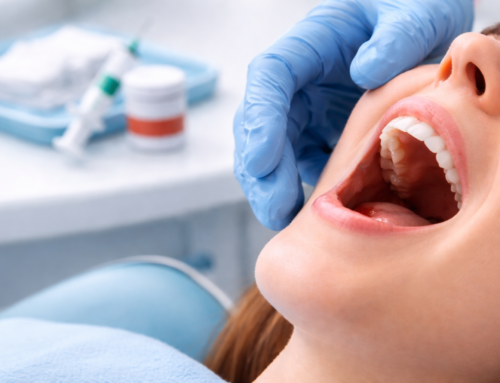 What to Expect Before, During, and After a Tooth Extraction