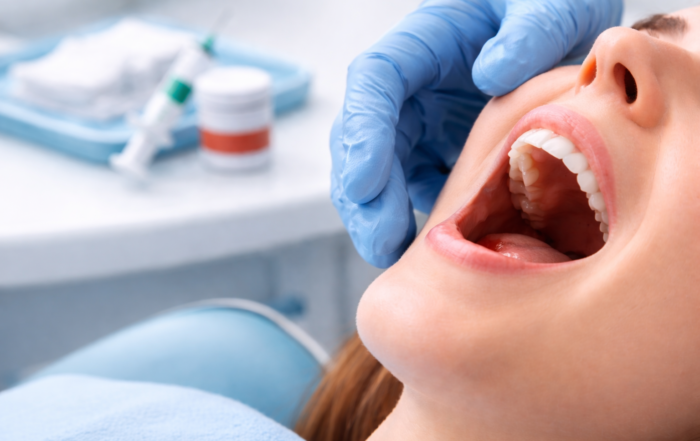 What to Expect Before, During, and After a Tooth Extraction