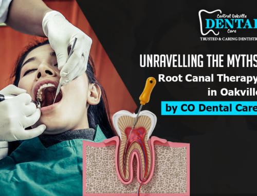 Unraveling the Myths: Root Canal Therapy in Oakville by CO Dental Care